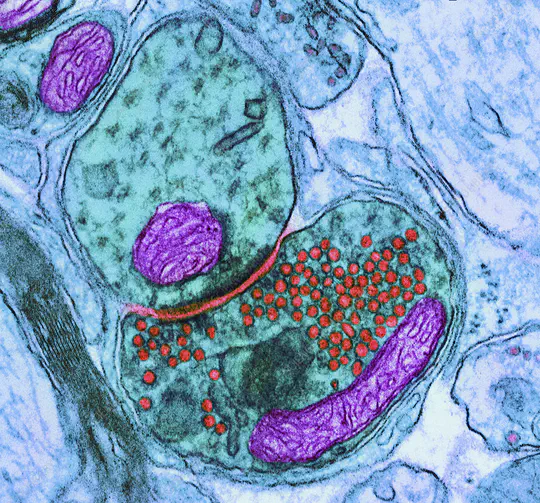 Aging and Aging-Related Diseases